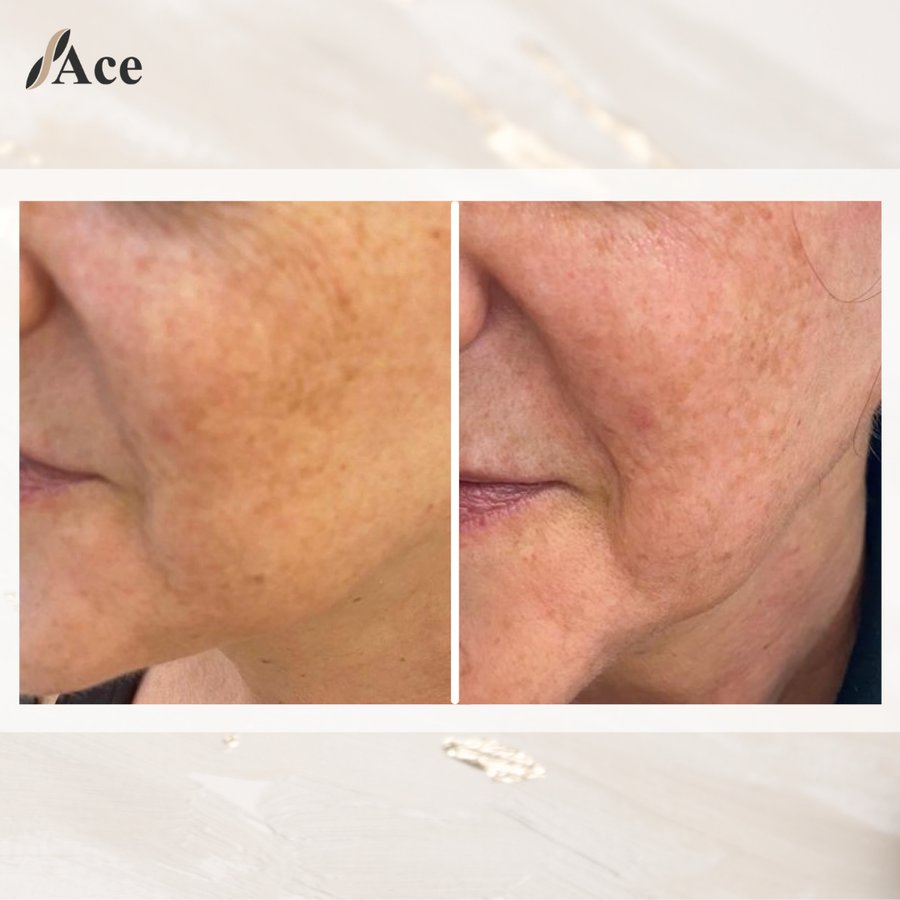 Ace Aesthetics - Ace Aesthetics